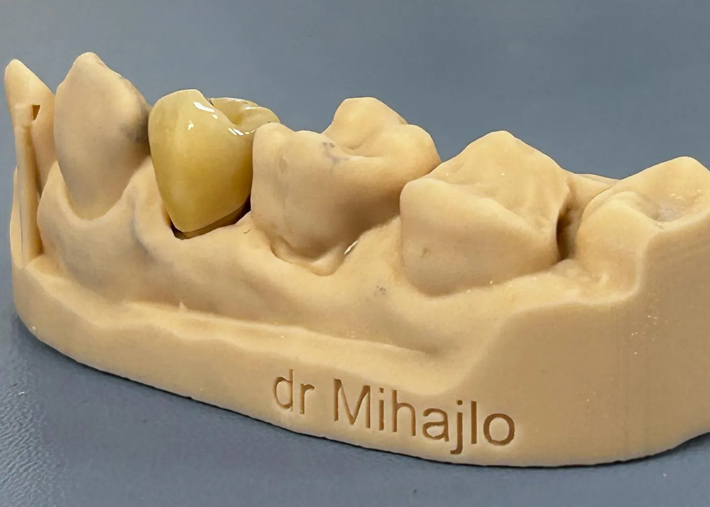 3D-štampani model vilice sa krunicom i natpisom „dr Mihajlo“